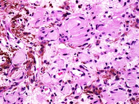 webpathology|Pathology images and text for medical education .